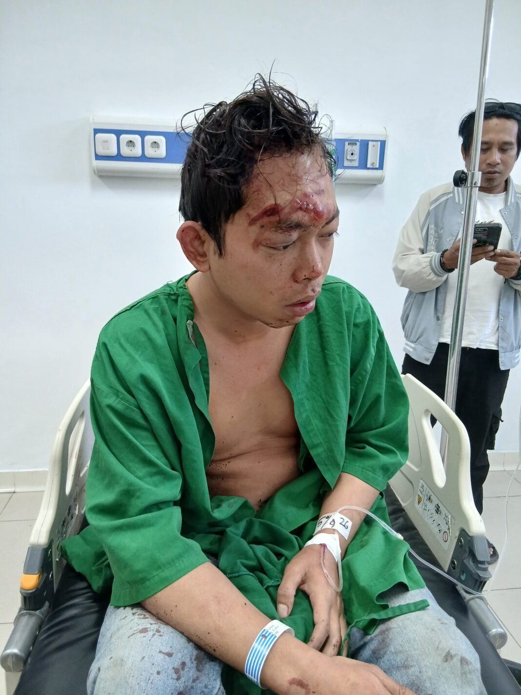 Ketua KNPI Lombok Barat Babak Belur, Dikeroyok dan Diduga Ditodong Senpi Ketua KNPI Lombok Barat Babak Belur, Dikeroyok dan Diduga Ditodong Senpi